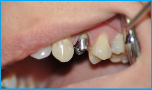 ��� �����