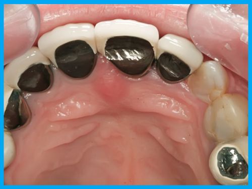 ��� �����