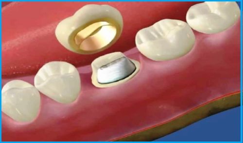 ��� �����