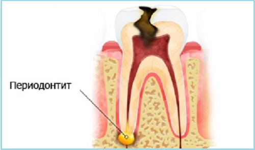 �����������-�������