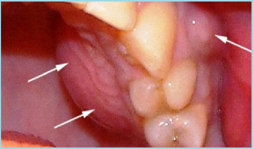 �����������-�������