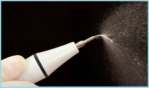 ultrazvulovaja-chistka-zubov